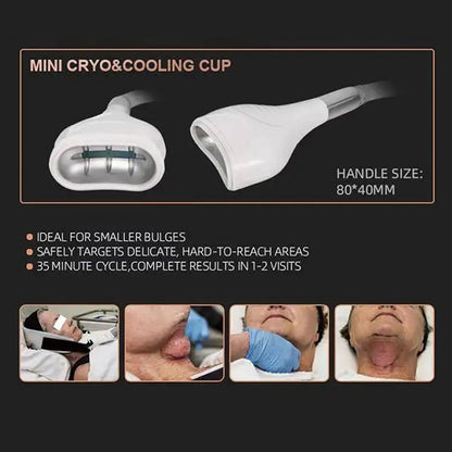4 In 1 Cryotherapy Machine Fat Freeze Body Slimming